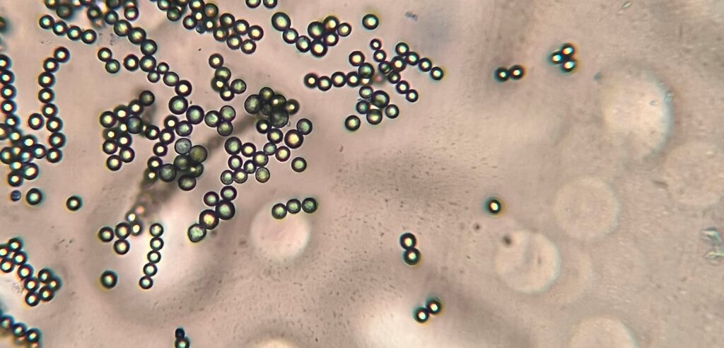 Indoor Air Quality Microbes